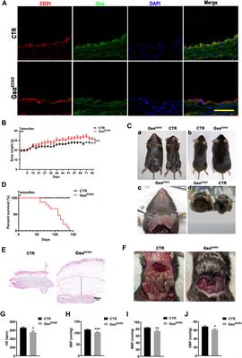 Stimulatory G-Protein α Subunit Modulates Endothelial Cell Permeability Through Regulation of Plasmalemma Vesicle-Associated Protein